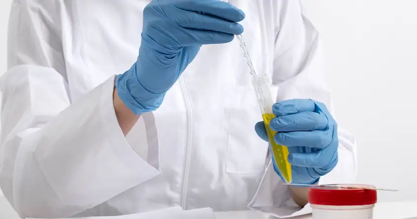 Understanding Teratospermia Test Results: What Do Abnormal Sperm ...